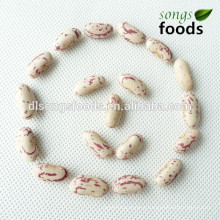 Long Type Light Speckled Kidney Bean From China Scientific Name Of Beans